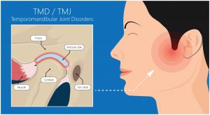 tmj specialist chandler az